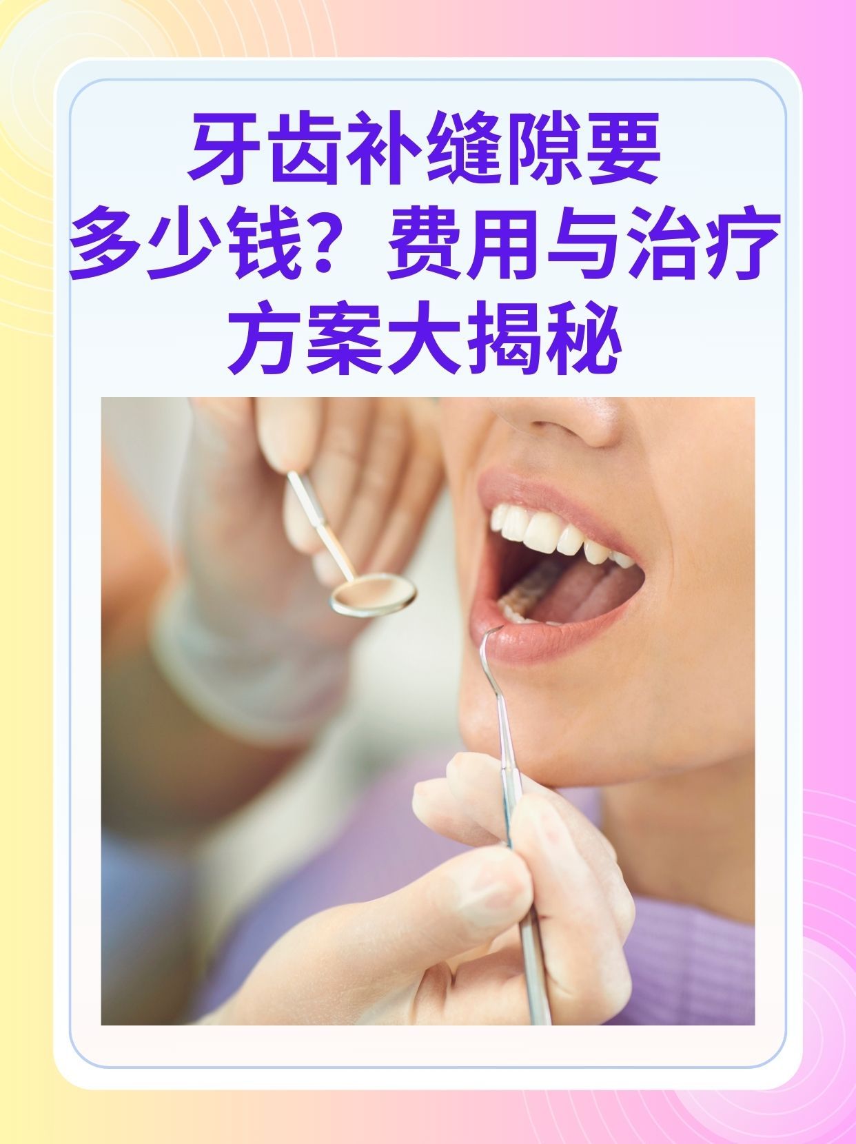 巢湖补牙医保可以报销吗(补牙医保可以报销吗 哪些可以报销呢)